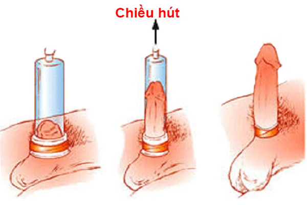 Máy tập dương vật Penis Enlargement Pump